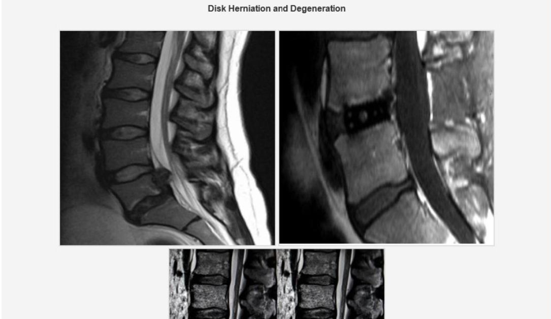 Imagen de la noticia: Iranian cyber spies used fake MRI scan results to hack ‘enemy of regime’ (The Record Cybersecurity)