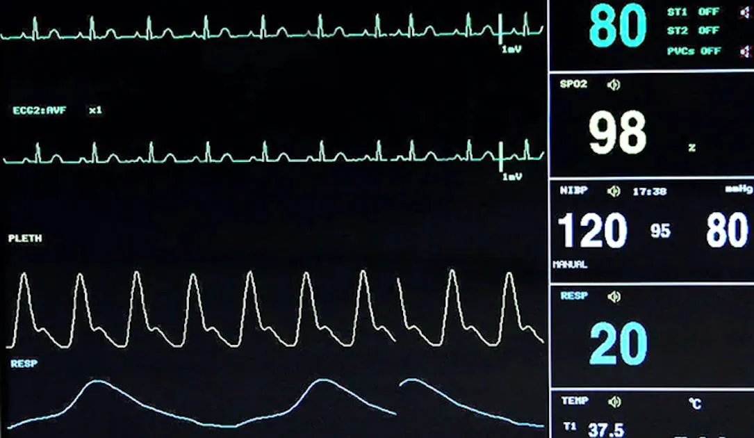 FDAとCISA、米国の病院で使用されている人気の患者モニターのバックドアを警告 from threcord.media(tech)
