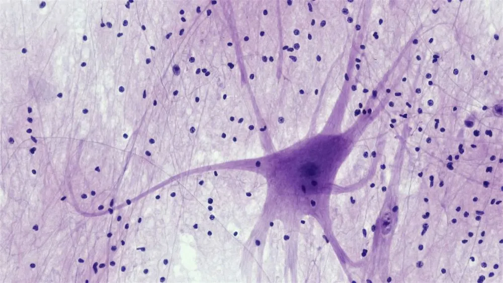 brain
